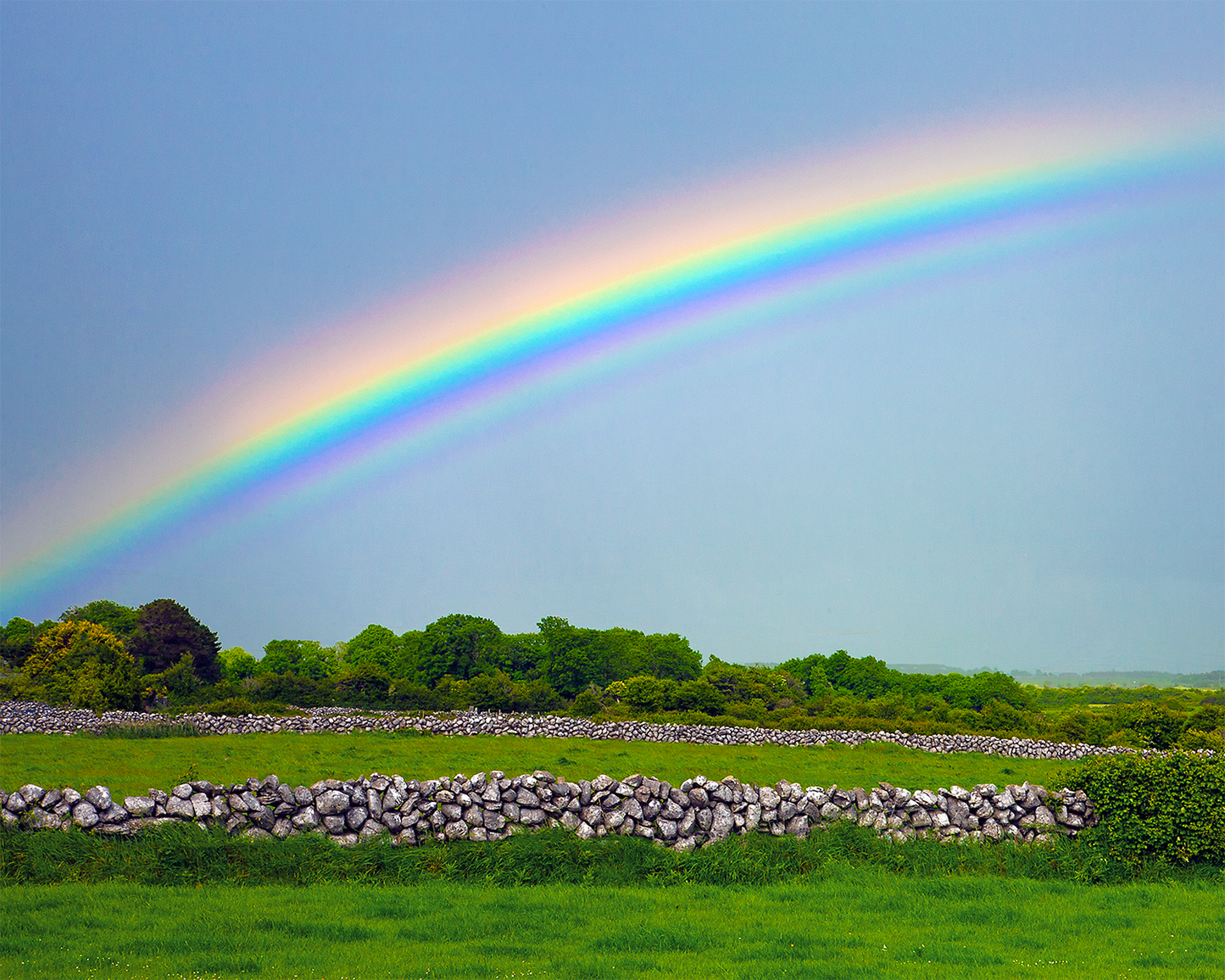 Irish Supernumerary